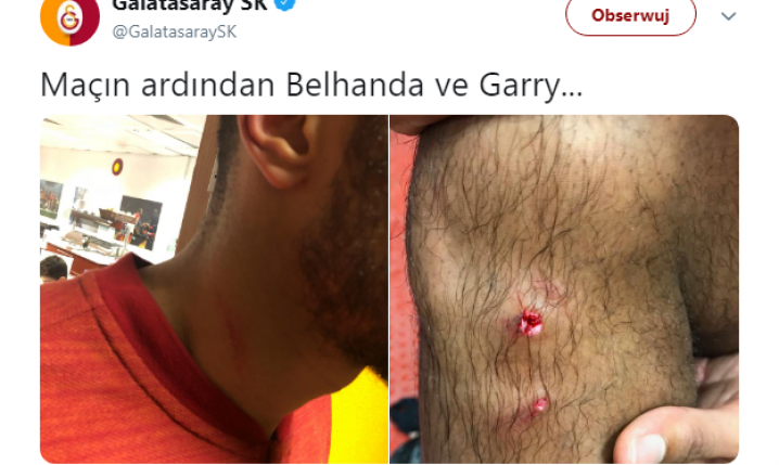 RANY piłkarzy Galatasaray po derbach z Fenerbahce